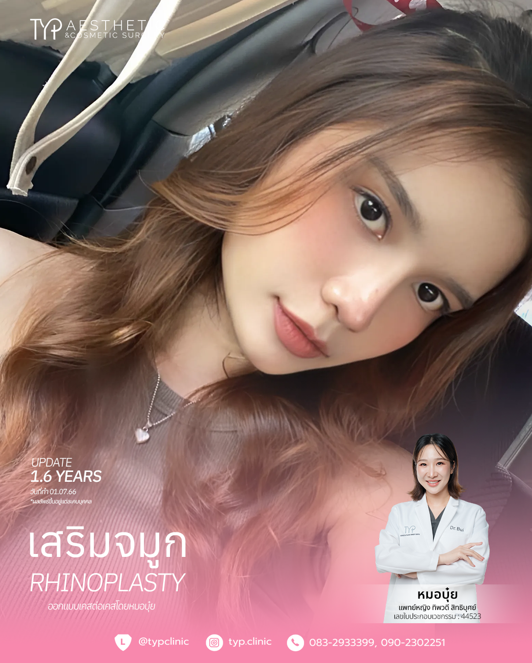 เสริมจมูก