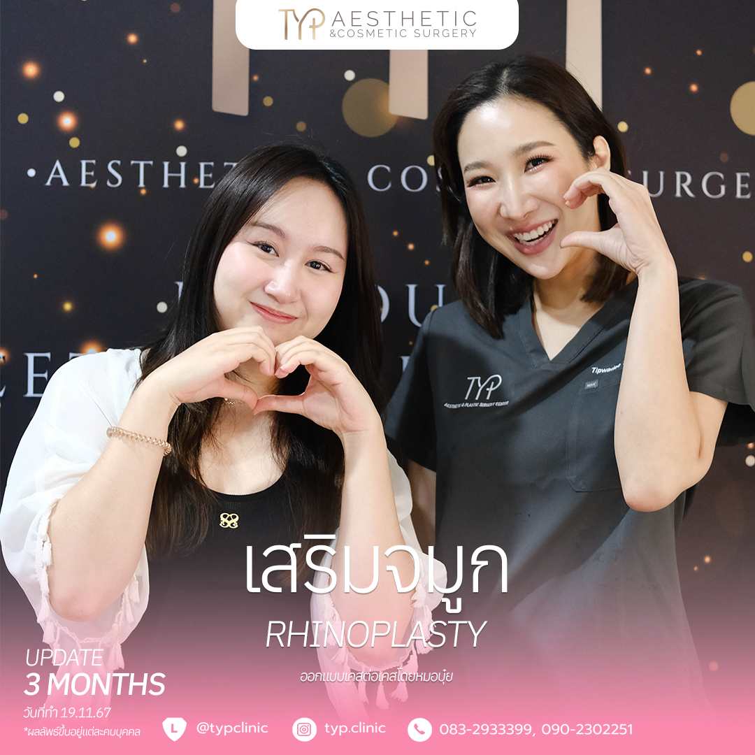 19.11.67 – 1 เสริมจมูก