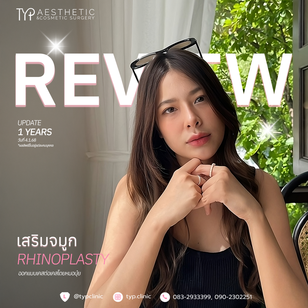 review เสริมจมูก – 18-1-68 -6 เสริมจมูก