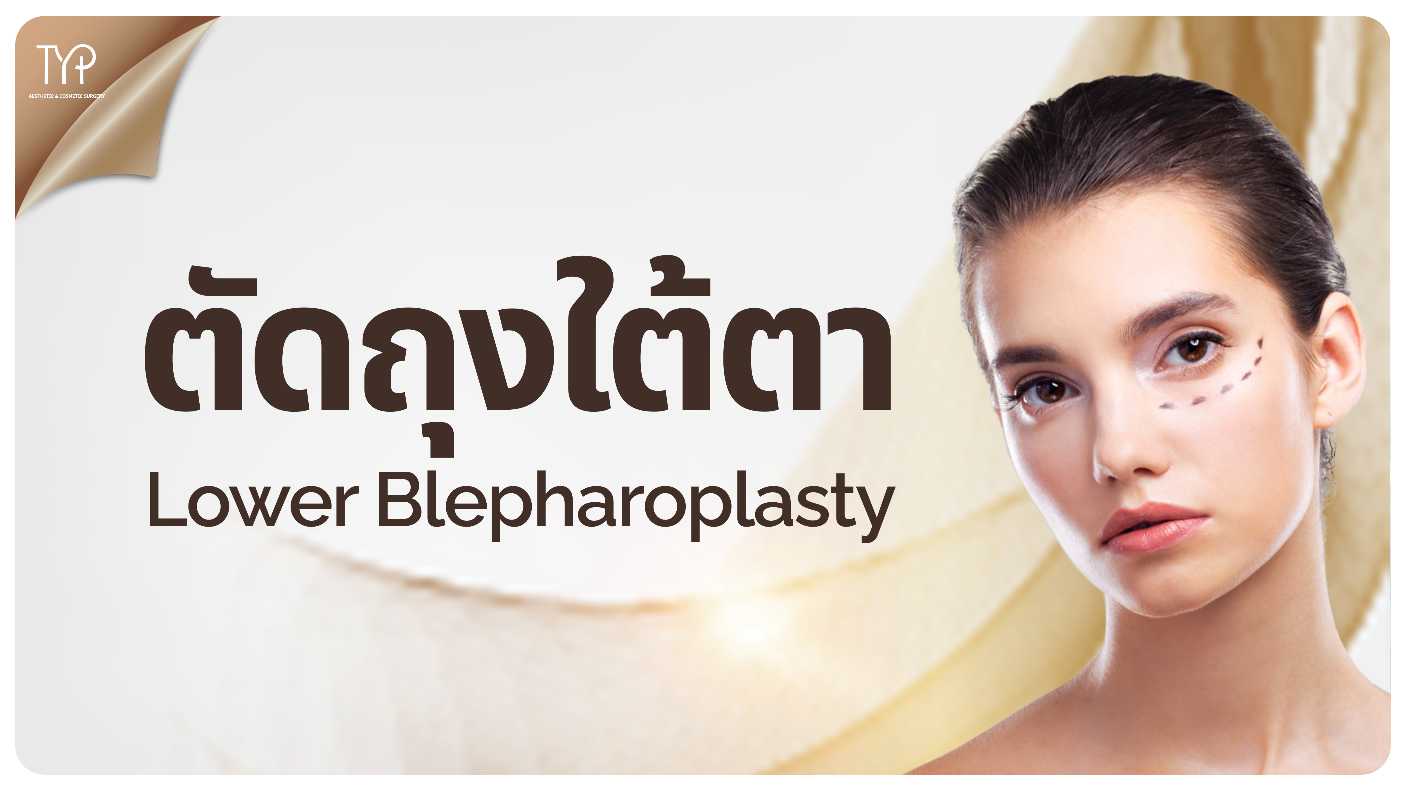 ตัดถุงใต้ตา