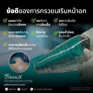 ข้อดีของการกรวยเสริมหน้าอก