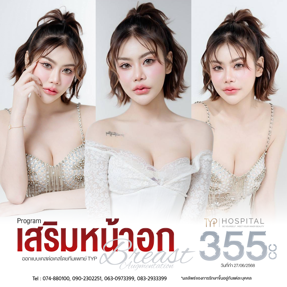 รีวิวเสริมหน้าอก TYP Hospital