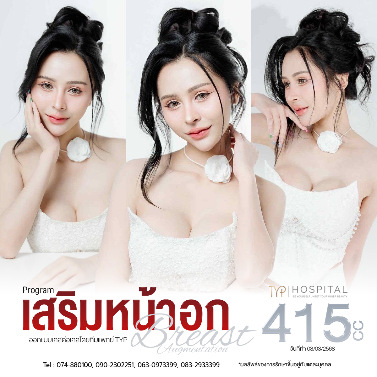 รีวิวเสริมหน้าอก TYP Hospital