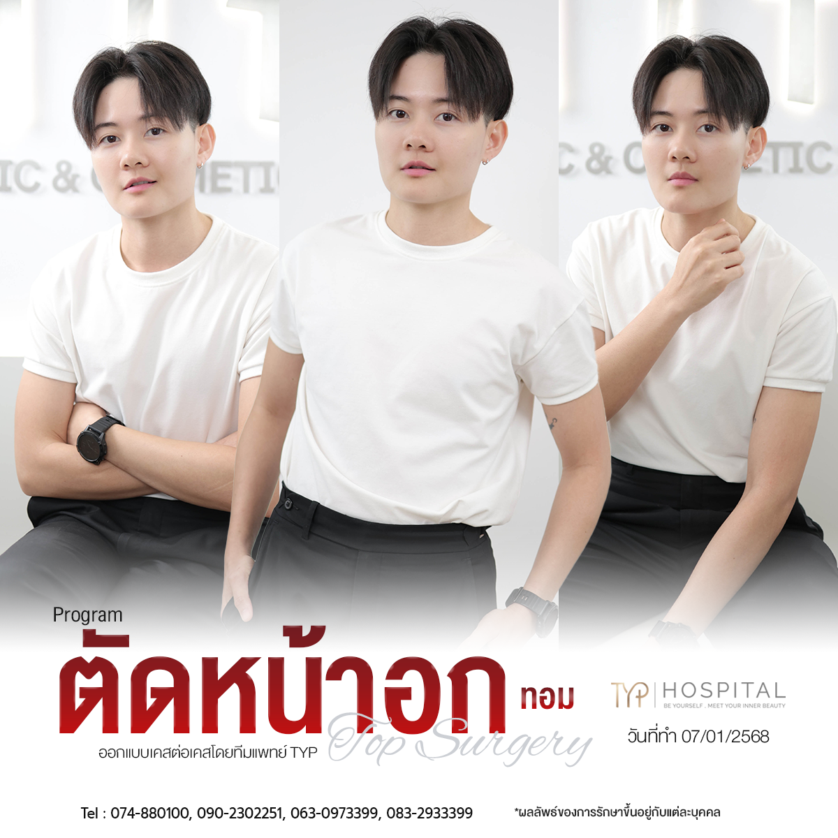 รีวิว ตัดหน้าอก TYP Hospital