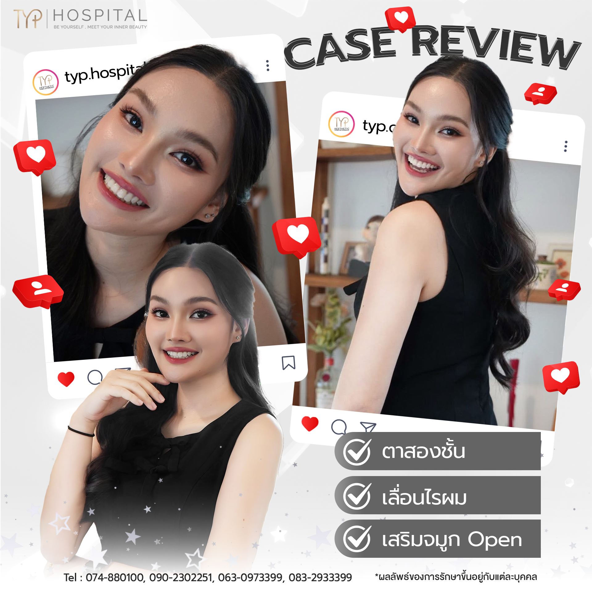 รีวิว CASE TYP Hospital