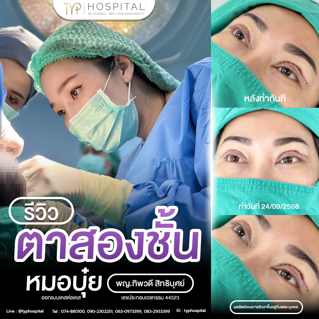 รีวิวตาสองชั้น TYP Hospital