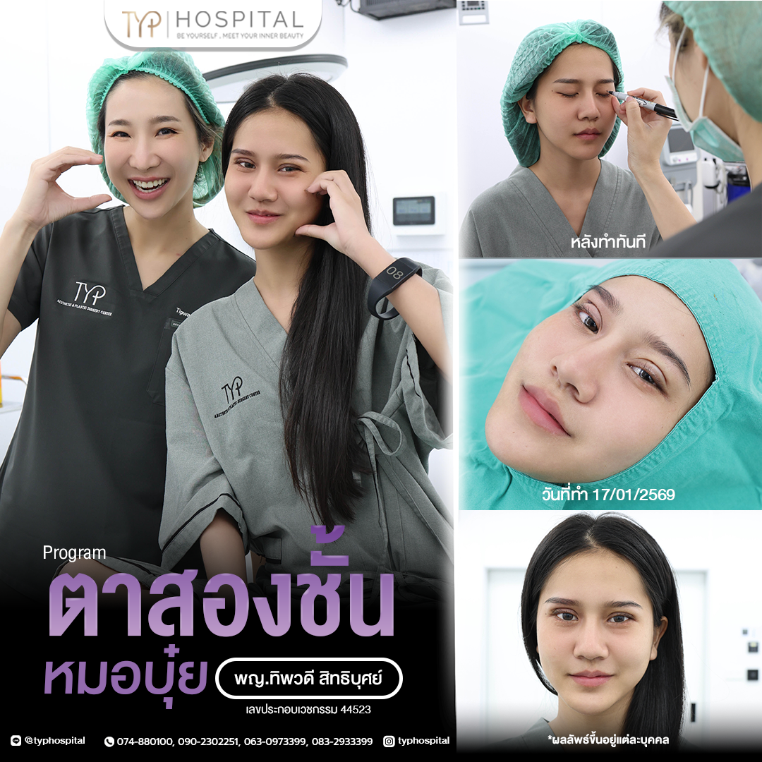 รีวิวตาสองชั้น TYP Hospital