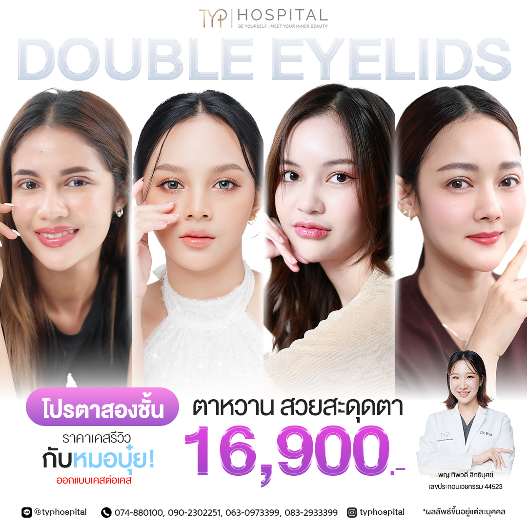 รีวิวตาสองชั้น TYP Hospital