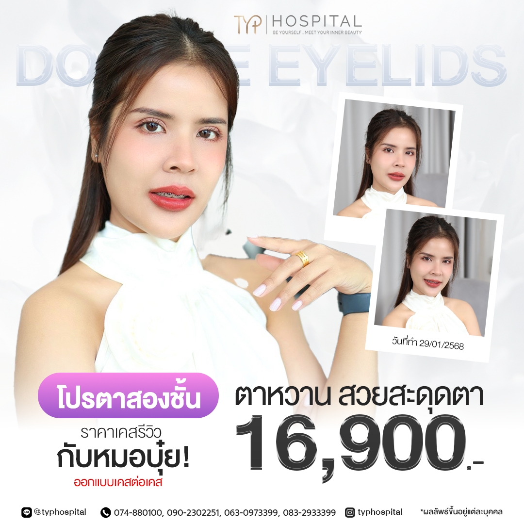 ตาสองชั้นรีวิว TYP Hospital
