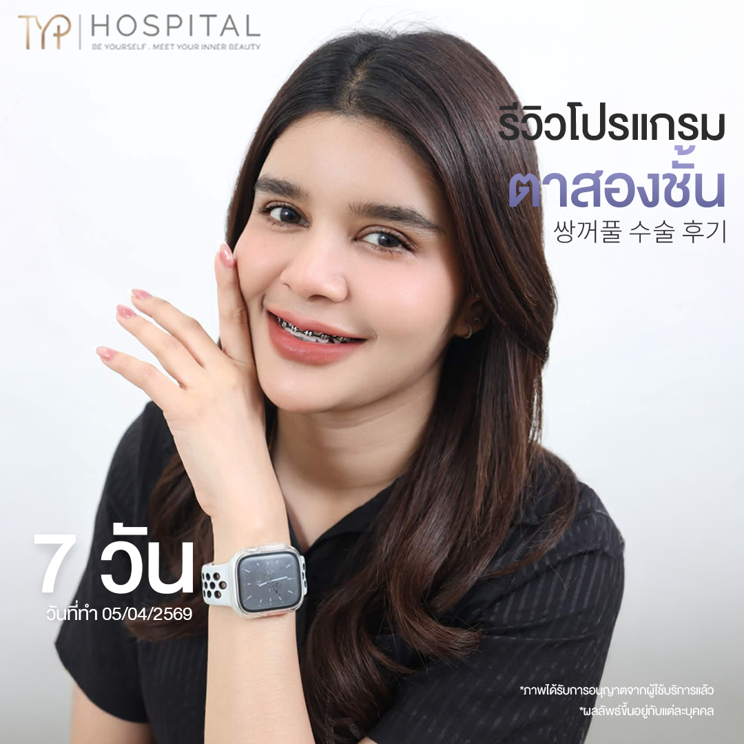 รีวิวตาสองชั้น TYP Hospital