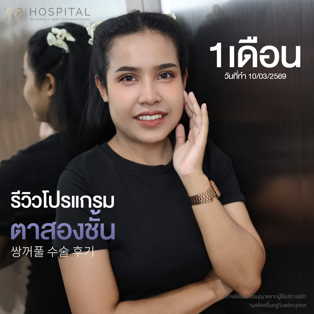 รีวิวตาสองชั้น TYP Hospital