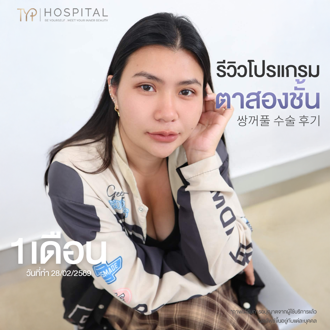 รีวิวตาสองชั้น TYP Hospital