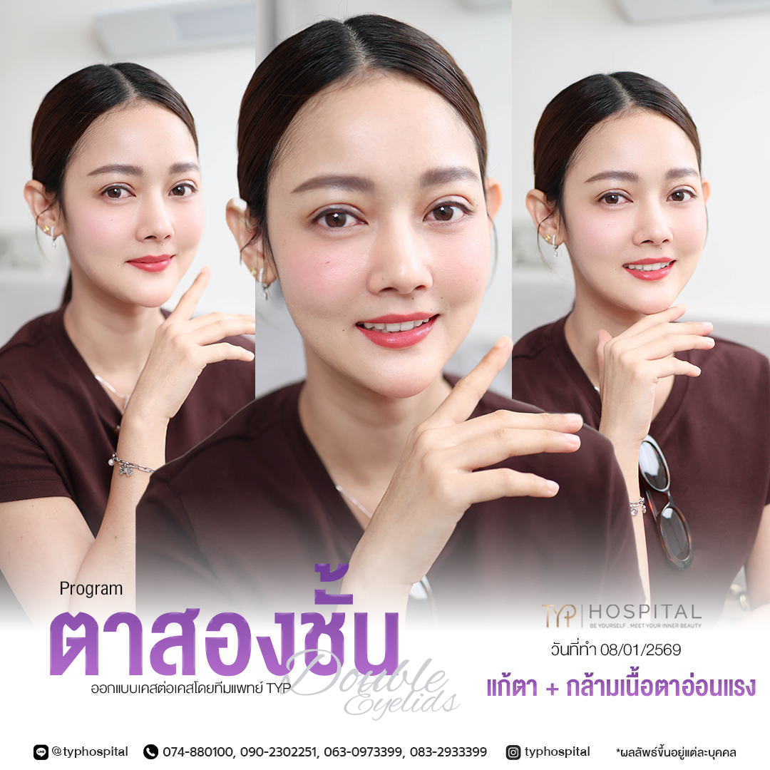 รีวิวตาสองชั้น TYP Hospital