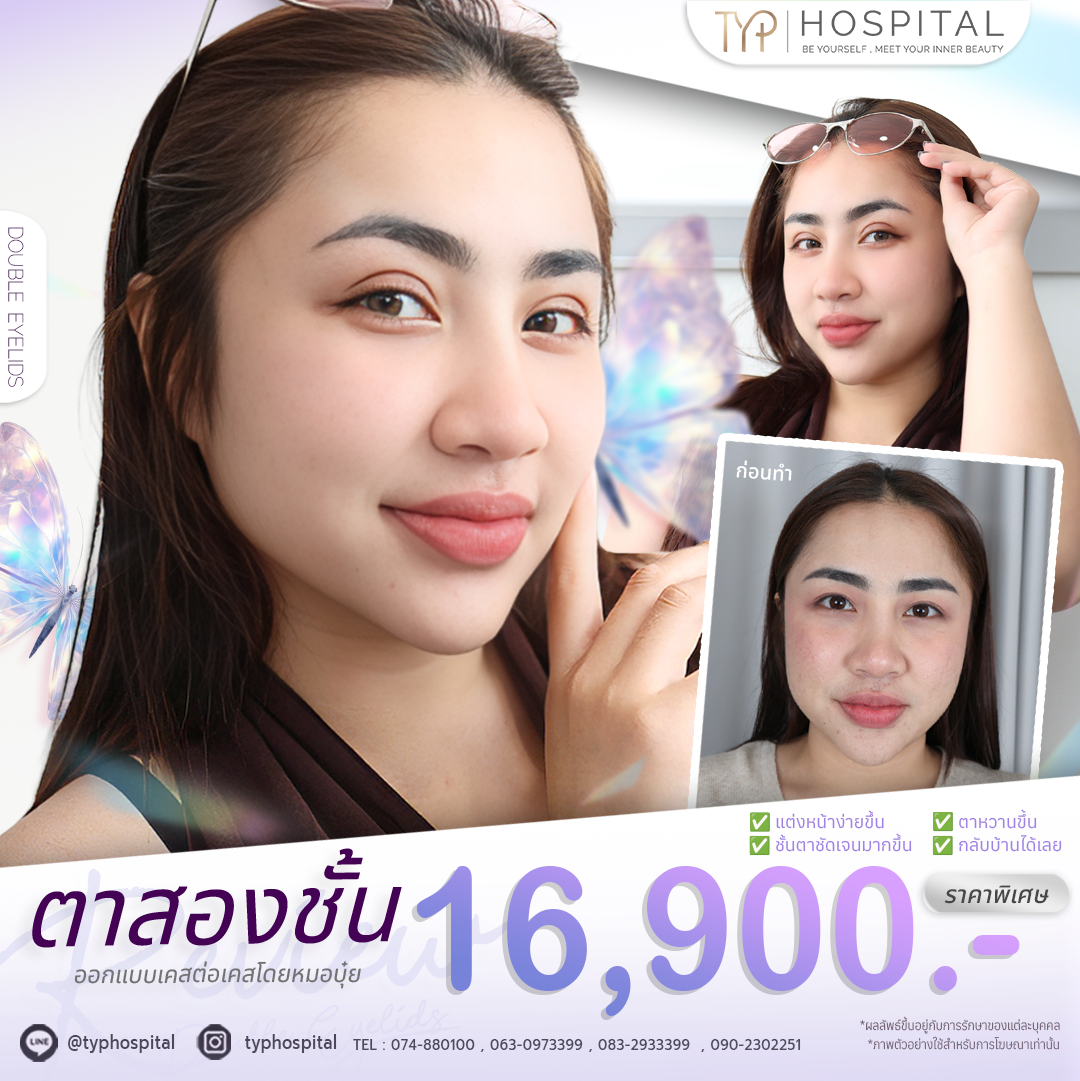 ตาสองชั้นรีวิว TYP Hospital