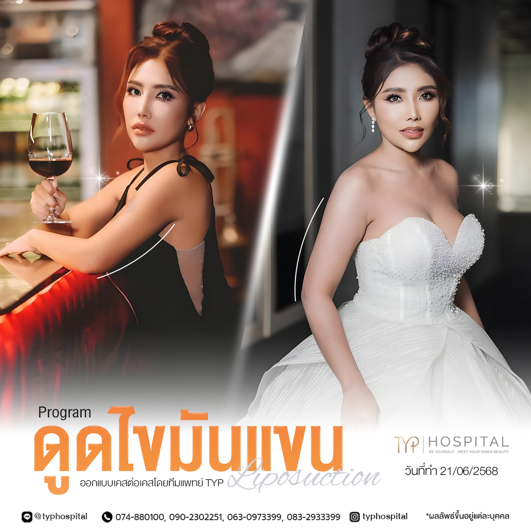 รีวิวดูดไขมัน TYP Hospital