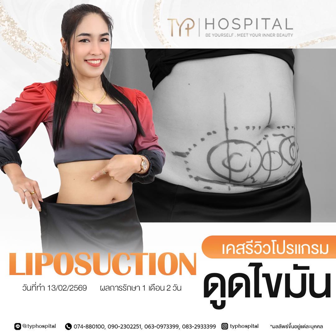 รีวิวดูดไขมัน TYP Hospital