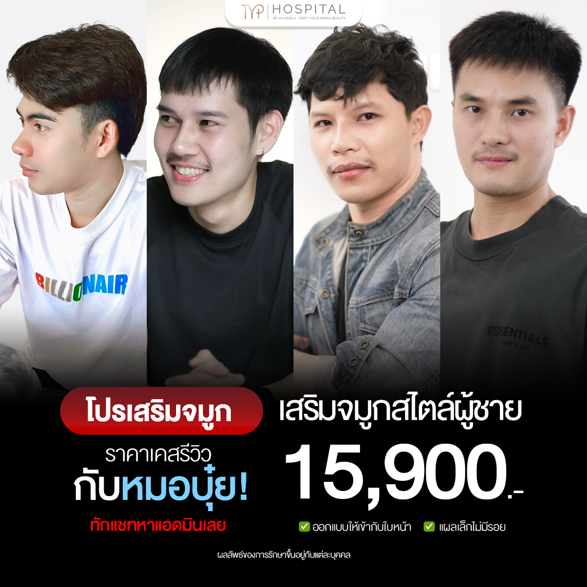 รีวิวจมูก TYP Hospital