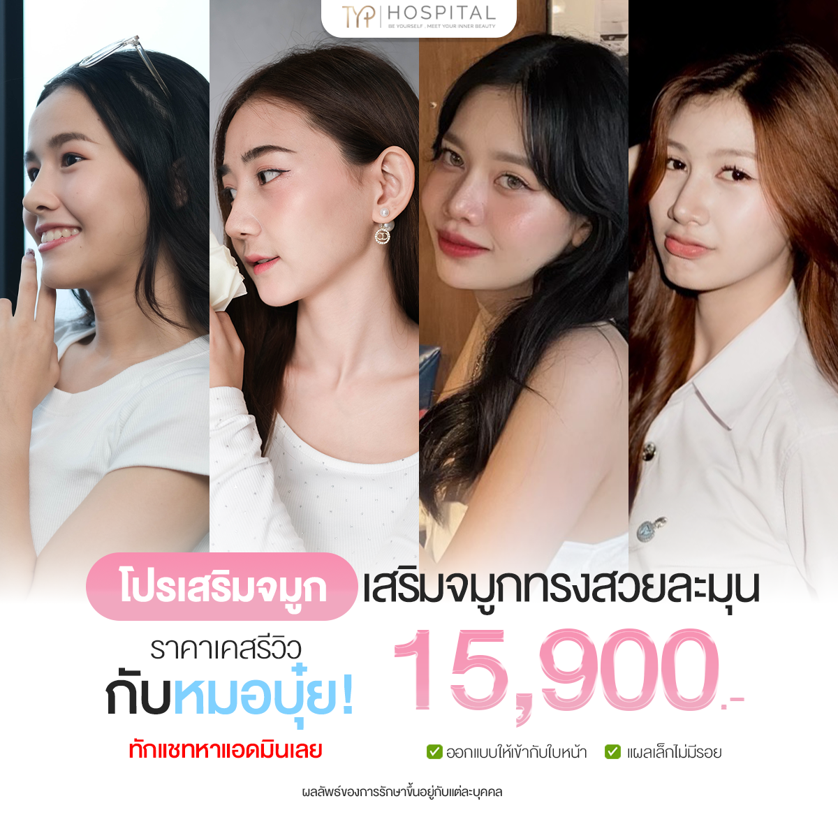 รีวิวจมูก TYP Hospital