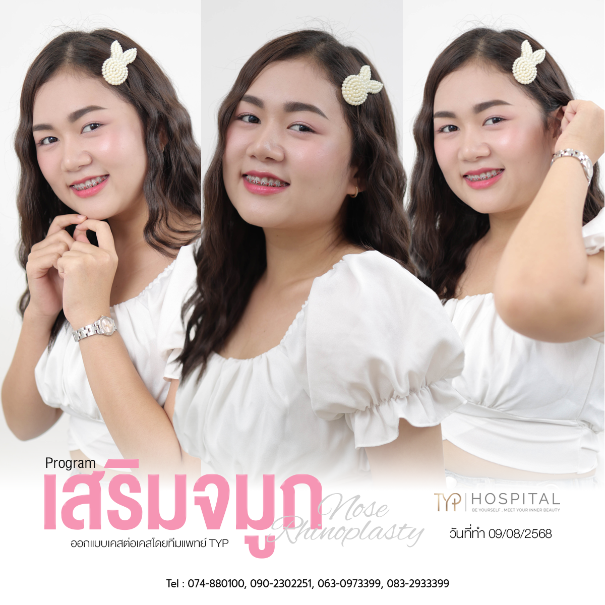 รีวิวจมูก TYP Hospital