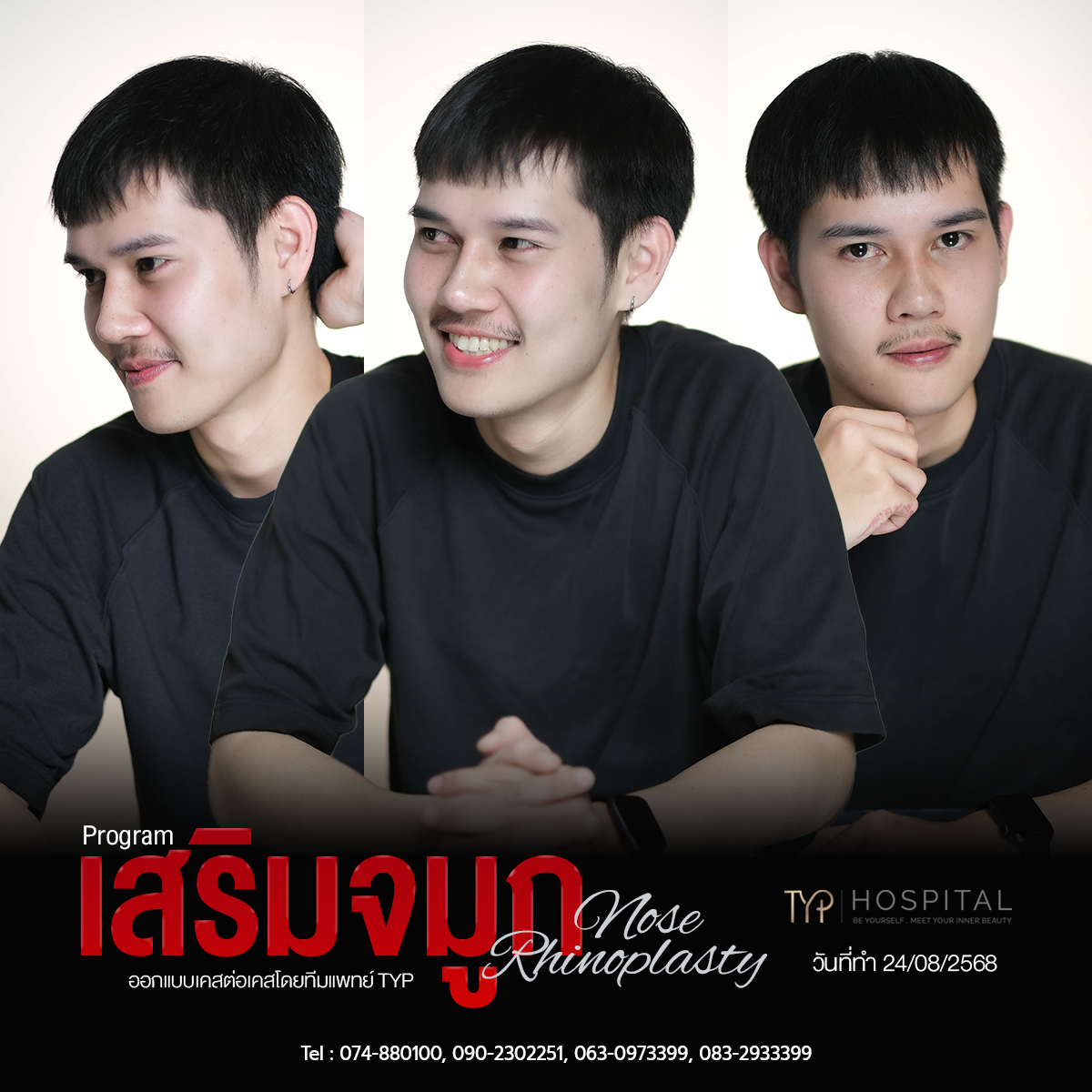 รีวิวจมูก TYP Hospital