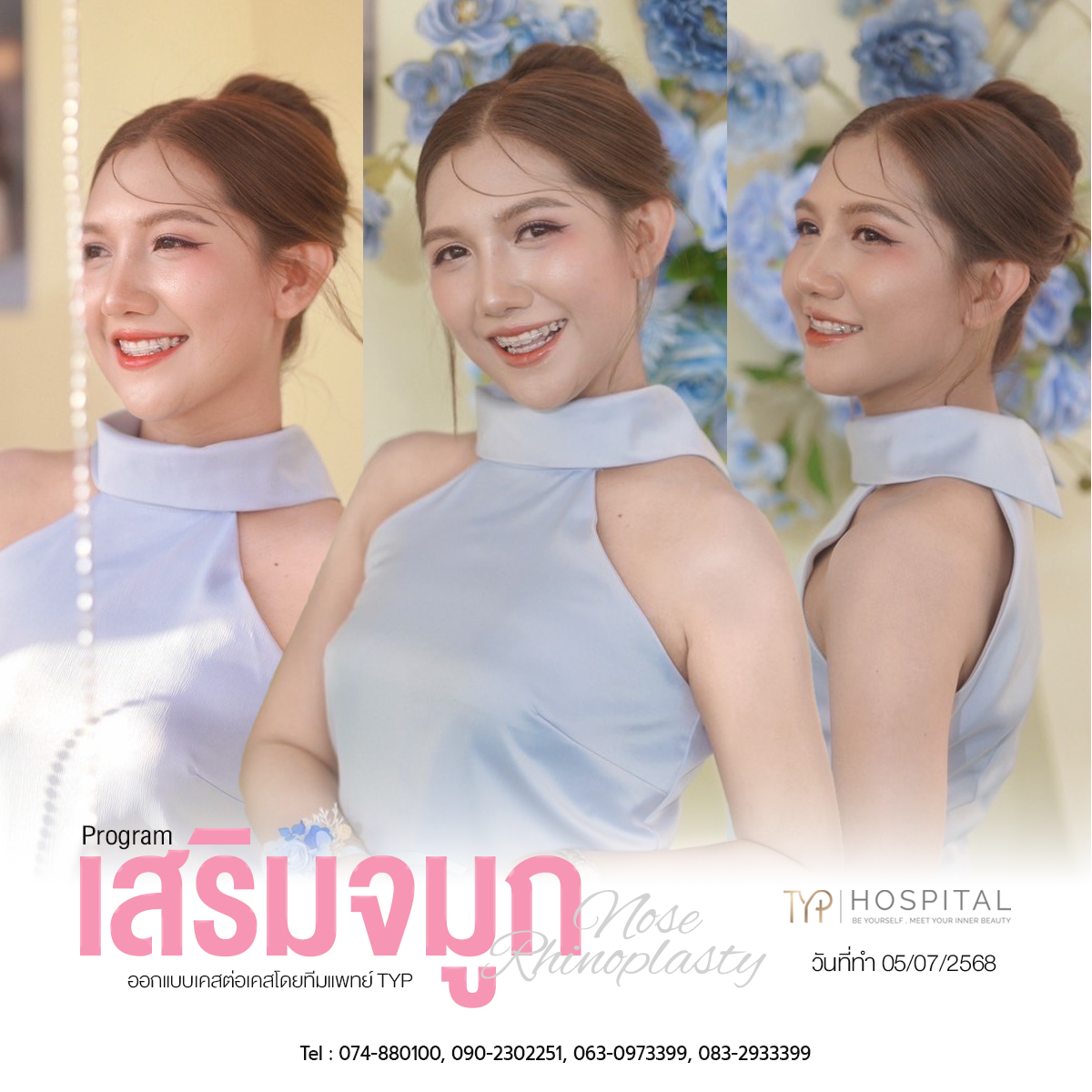 รีวิวจมูก TYP Hospital