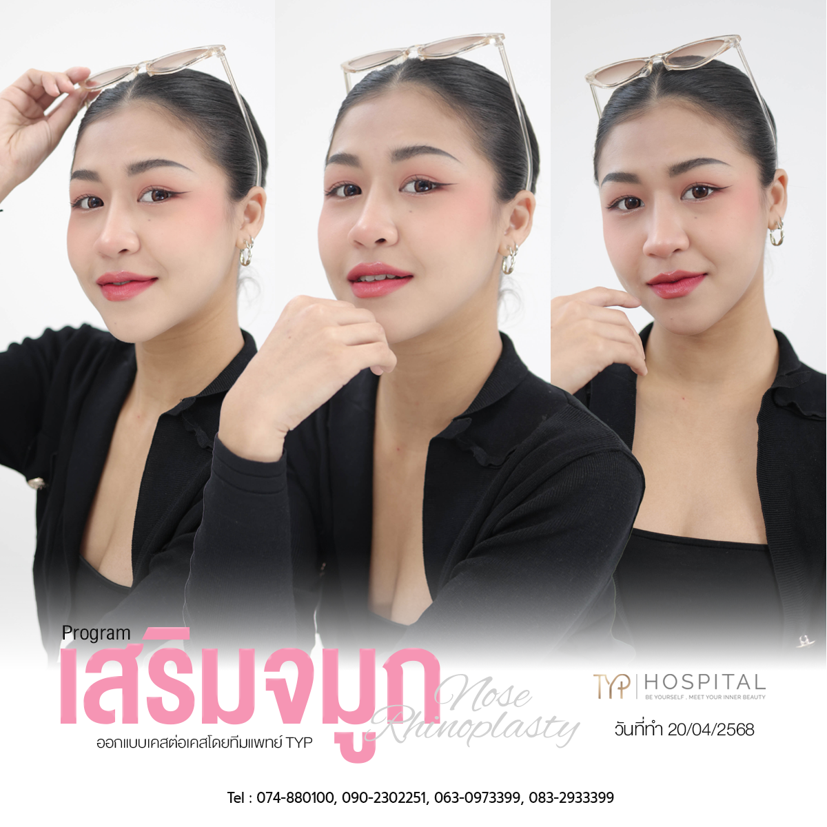 รีวิวจมูก TYP Hospital