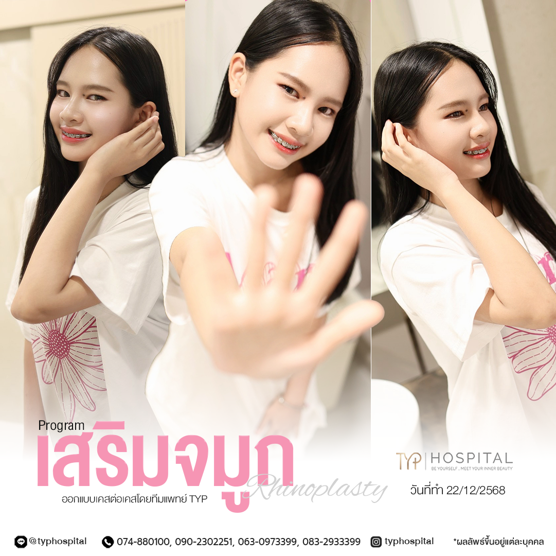 รีวิวจมูก TYP Hospital