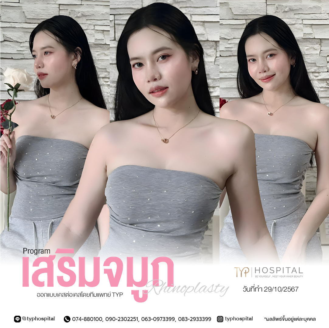 รีวิวจมูก TYP Hospital