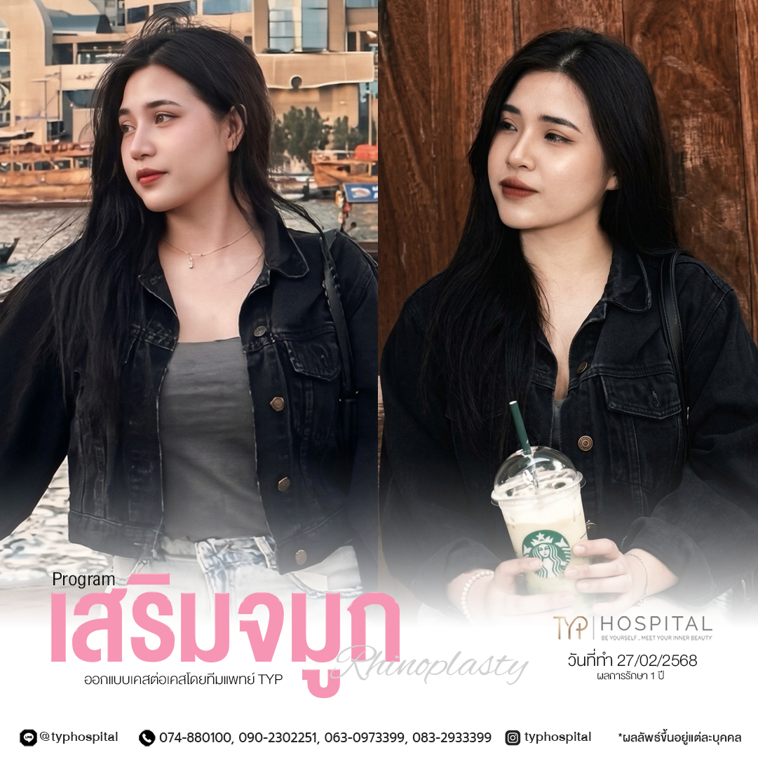 รีวิวจมูก TYP Hospital