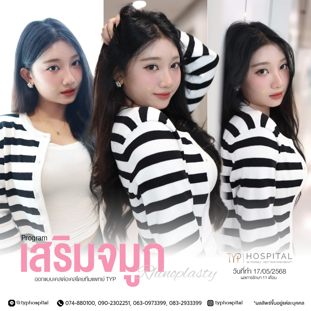 รีวิวจมูก TYP Hospital