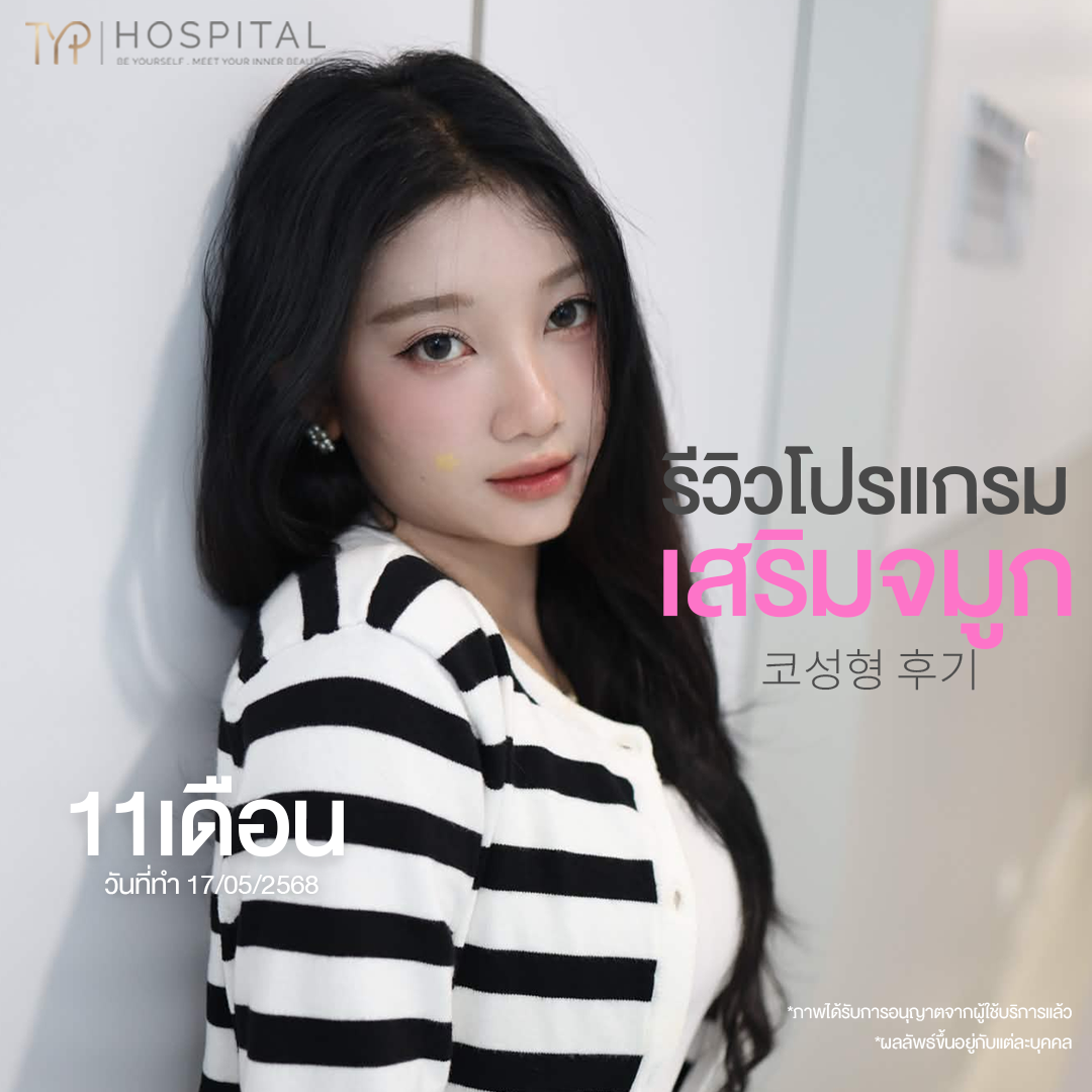 รีวิวจมูก TYP Hospital