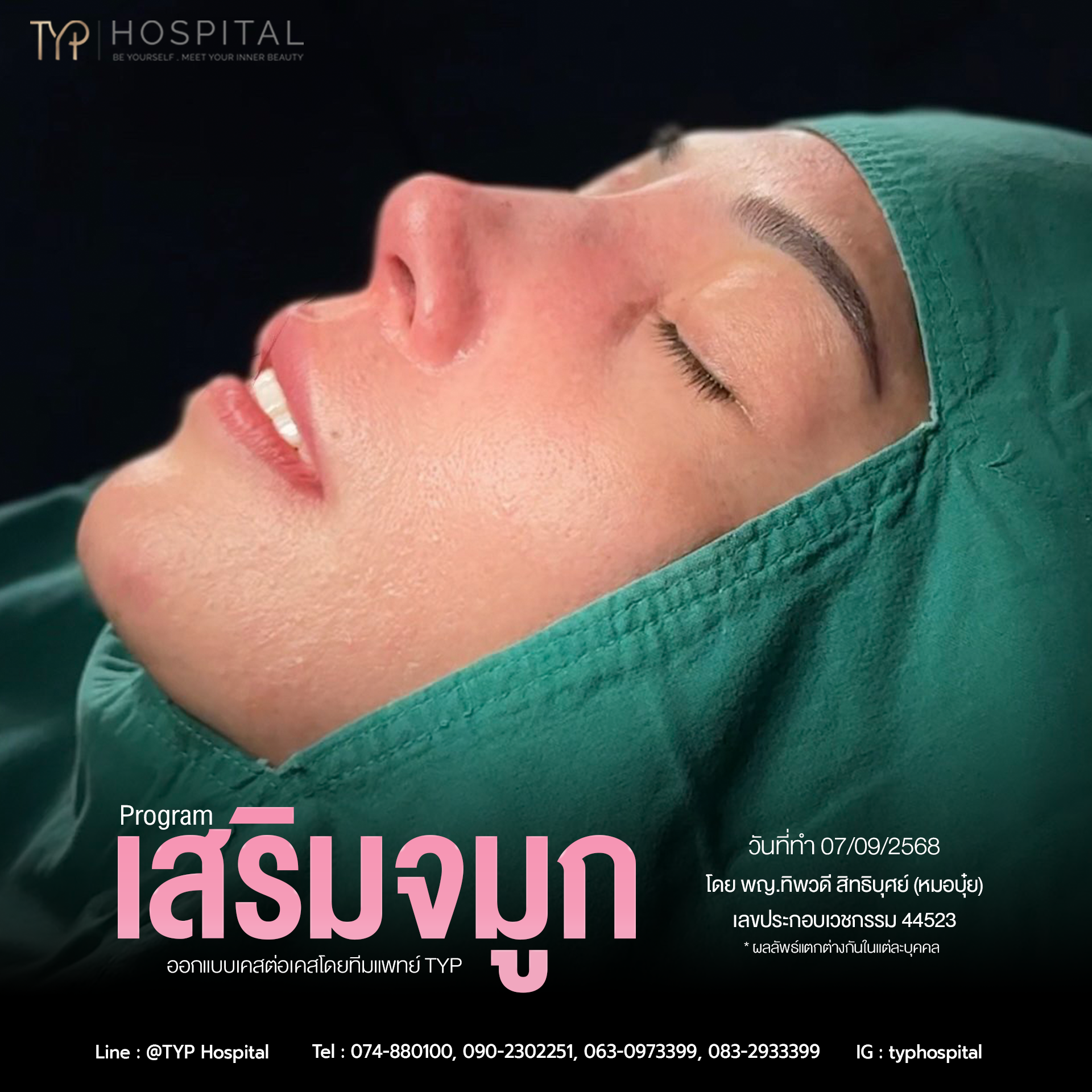 รีวิวจมูก TYP Hospital
