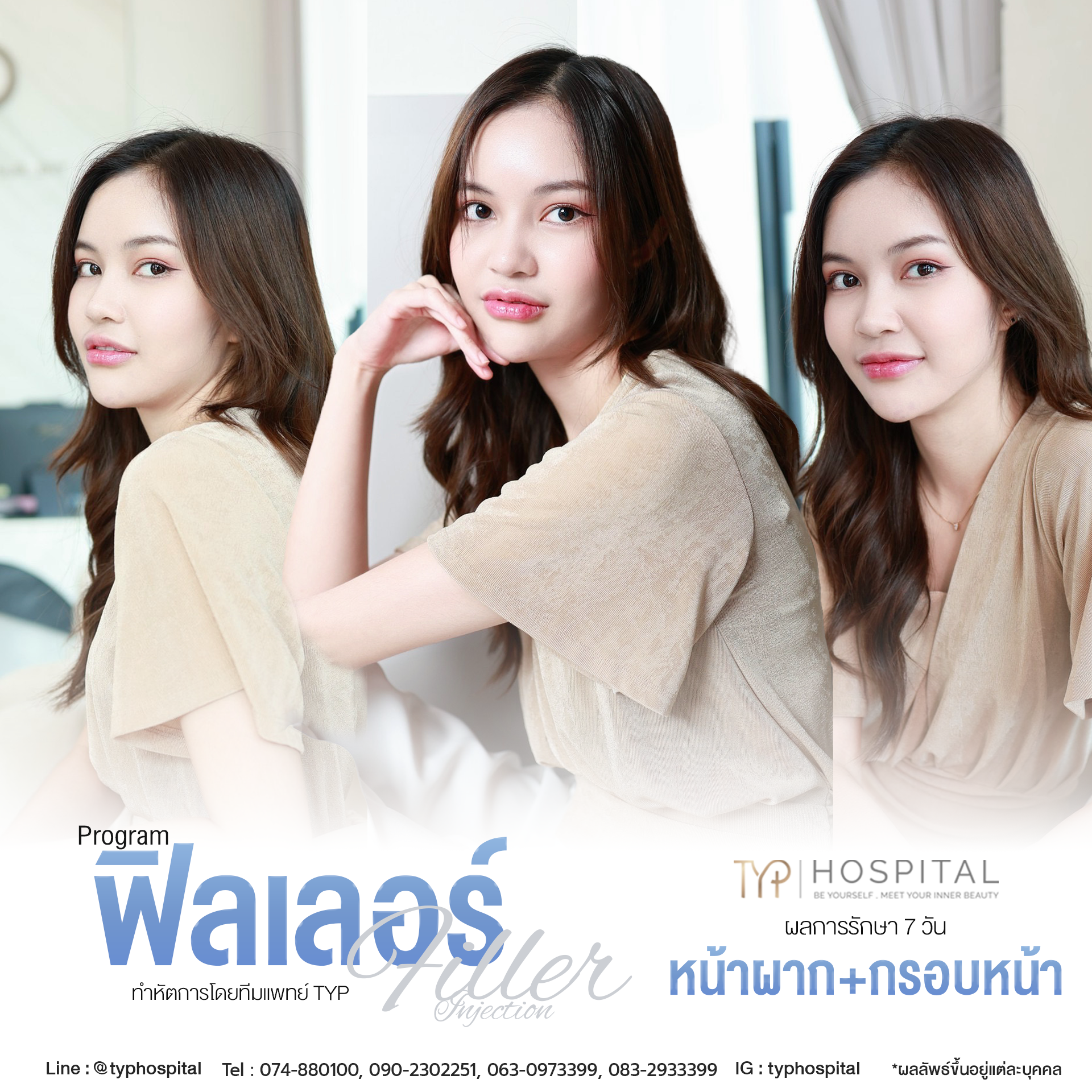รีวิวฟิลเลอร์ TYP Hospital
