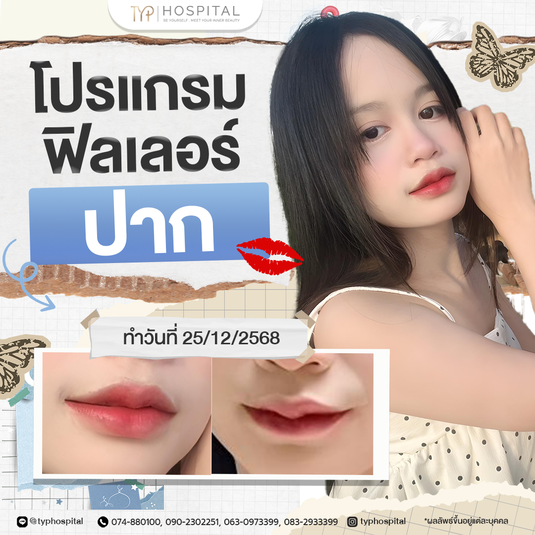 รีวิวฟิลเลอร์ TYP Hospital