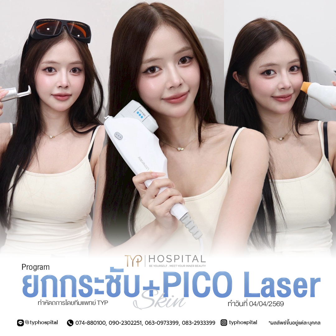 รีวิว Pico Laser - TYP Hospital