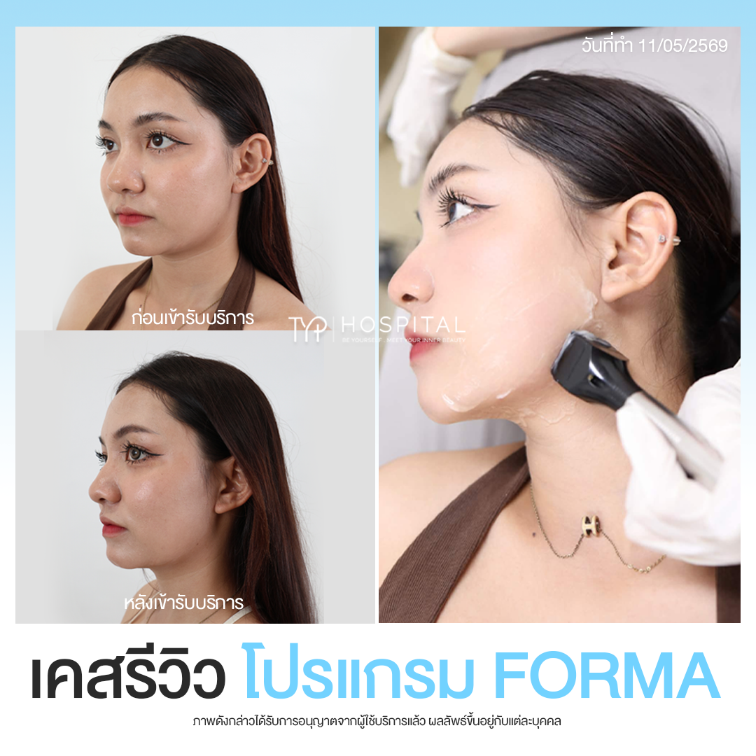 รีวิว Forma - TYP Hospital