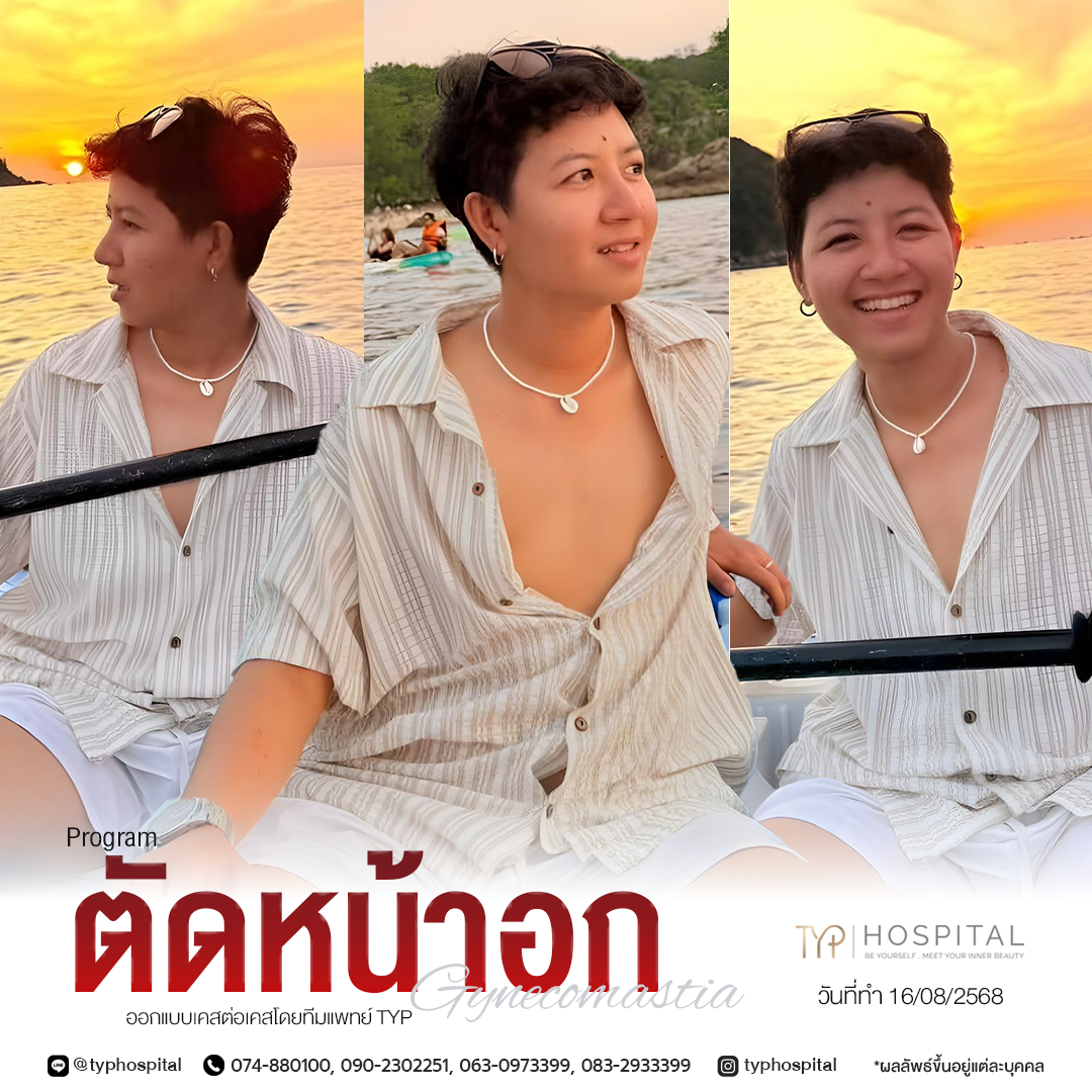 รีวิวตัดหน้าอก - TYP Hospital