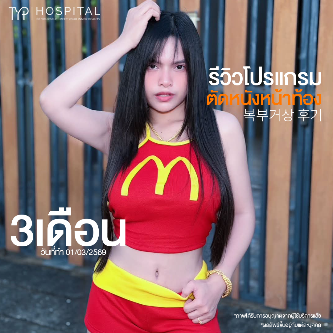 รีวิวตัดหนังหน้าท้อง TYP Hospital