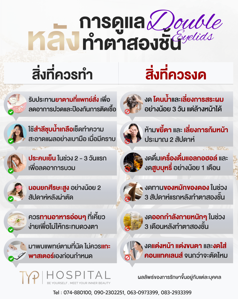 ตาสองชั้น 12 การดูแลหลังทำตาสองชั้น - TYP Hospital