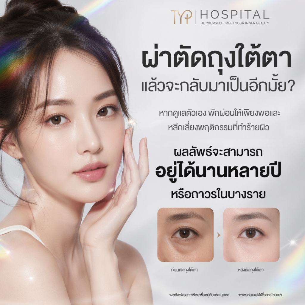 ถุงใต้ตา 9 ผ่าตัดถุงใต้ตาอยู่ได้นานไหม? - TYP Hospital