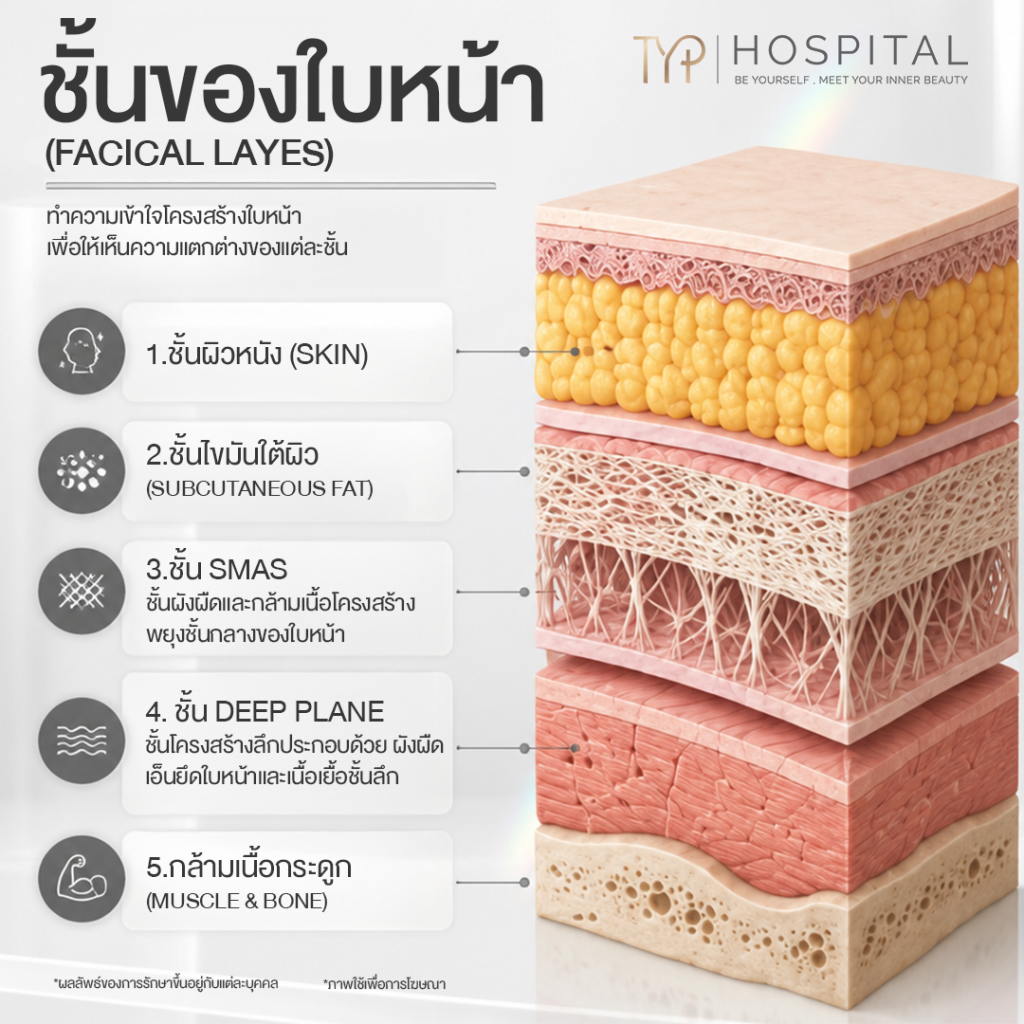 ดึงหน้า 5 ชั้นของใบหน้า - TYP Hospital