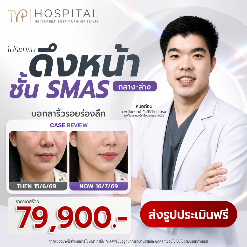 โปรดึงหน้าชั้น SMAS – TYP Hospital โปรดึงหน้าชั้น SMAS - TYP Hospital