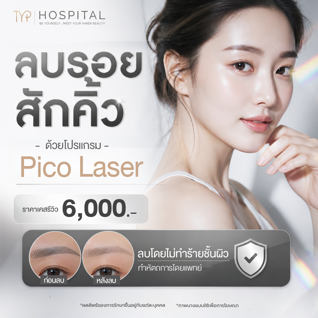 Pico laser ลบรอยสักคิ้ว – TYP Hospital Pico laser ลบรอยสักคิ้ว - TYP Hospital