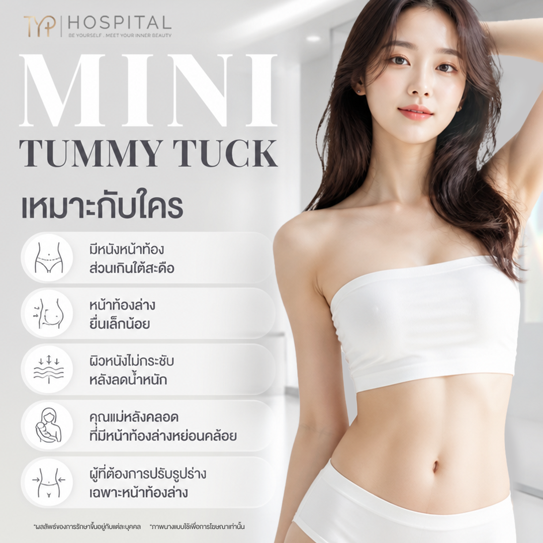 ตัดหนังหน้าท้องแบบ Mini เหมาะกับใคร - TYP Hospital