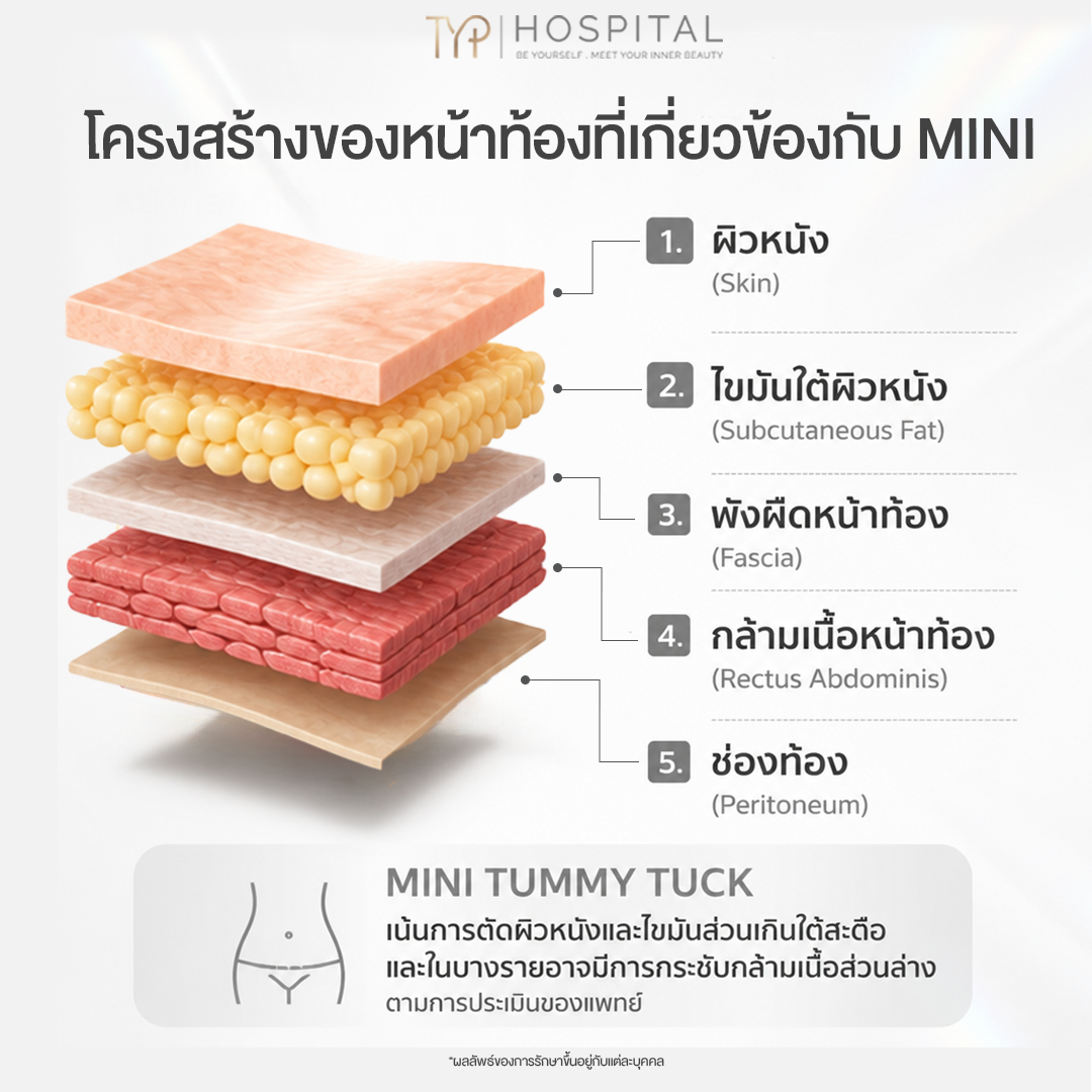 โครงสร้างหนังหน้าท้อง - TYP Hospital