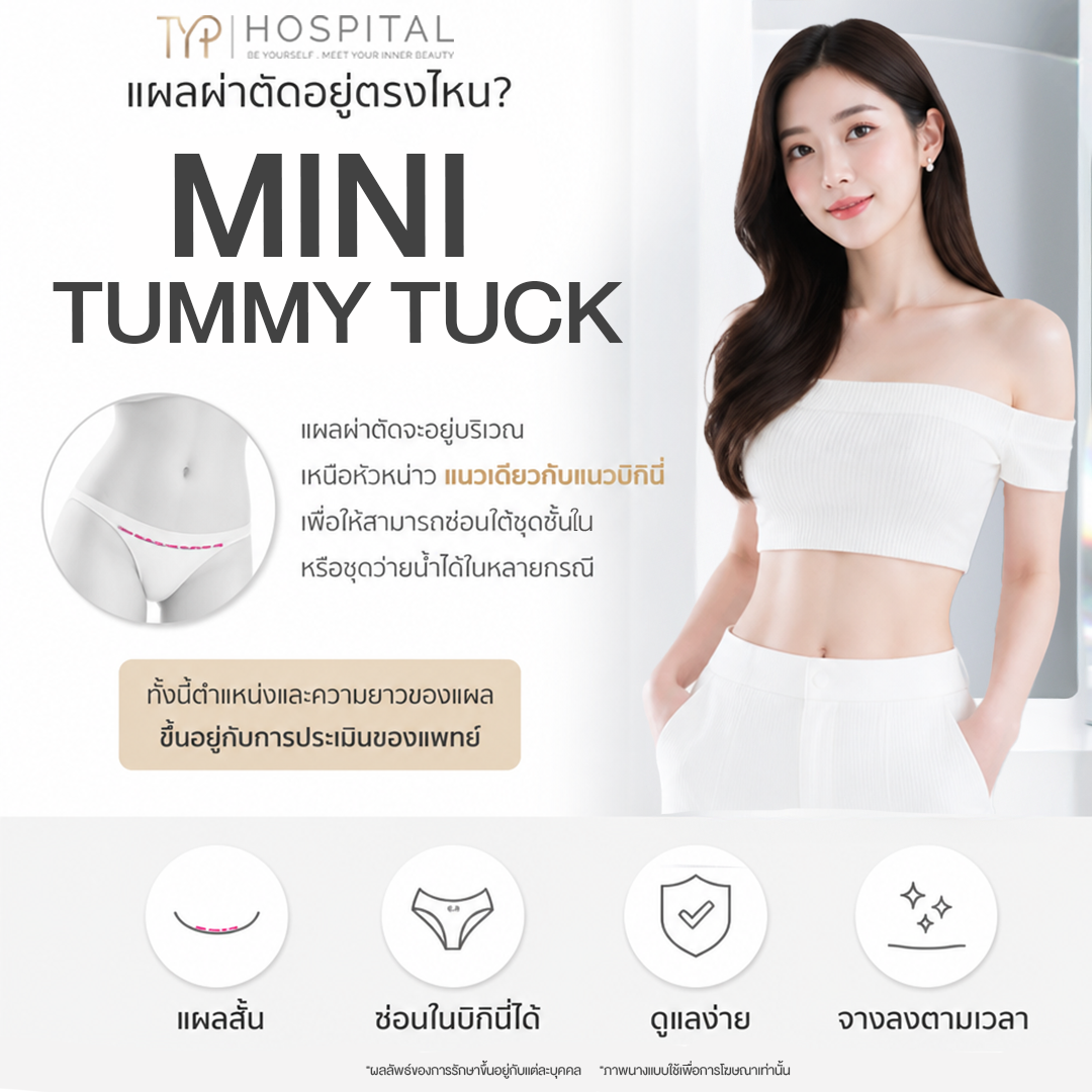 ตัดหนังหน้าท้อง - TYP Hospital