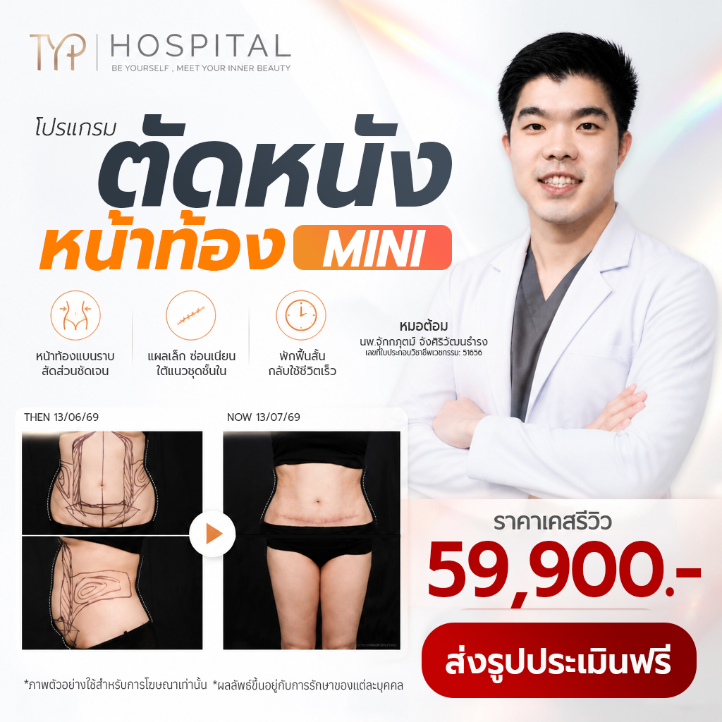 โปรดึงตัดหนังหน้าท้อง – TYP Hospital โปรดึงตัดหนังหน้าท้อง - TYP Hospital